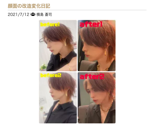 整形、ヘアチェンジでカッコよさ倍増！　イケメンセラピの「Before→ After」大公開！　